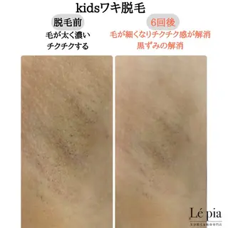 美容脱毛専門店 Lé pia レピアのエステ・リラクイメージ