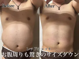 六本木脱毛andS 店長Sachiのエステ・リラクイメージ