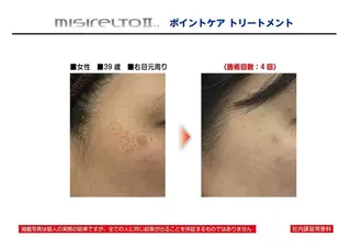 ANGEL NAIL所属・RE:BORN 大阪四條畷市のエステ・リラクイメージ