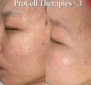 Blooming所属・LOUISE. ／肌質・頭皮のエステ・リラクイメージ