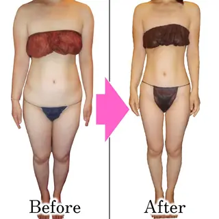 ダイエットラボ梅田店 🌟のエステ・リラクイメージ