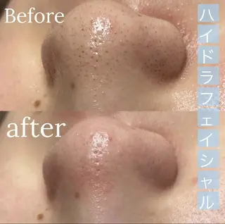 Lilyboo 星のエステ・リラクイメージ