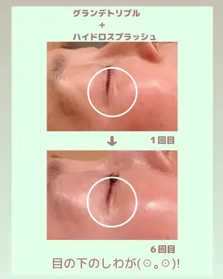 ラブニール 恵比寿店のエステ・リラクイメージ