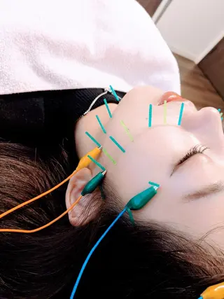 小顔美容鍼灸Acubelle Yakuin.【アキュベル薬院】所属・石川 真梨奈  美容鍼灸/アロマのエステ・リラクイメージ