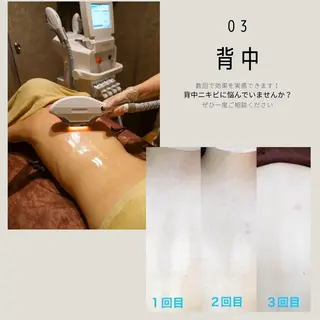 男女同額完全個室脱毛 LEPIA内田のエステ・リラクイメージ