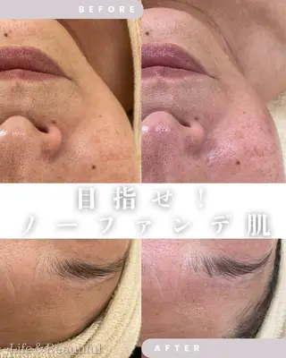 Life＆ Beautifulのエステ・リラクイメージ