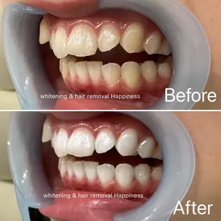 Happiness 心斎橋アメ村本店のその他イメージ