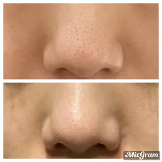 Pono所属・Pono （ポノ）のその他イメージ