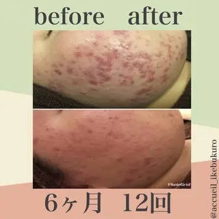 ミディアム カラー パーマ ヘアアレンジ メンズ キッズ ネイル マツエク・マツパ ニキビ・肌質改善専門 ♡人生が変わるサロンのエステ・リラクイメージ