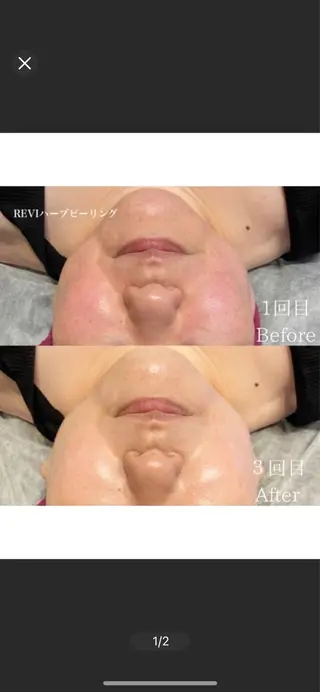 Tug エステサロン　高知駅前店所属・高知駅店Tug NONOKAのエステ・リラクイメージ