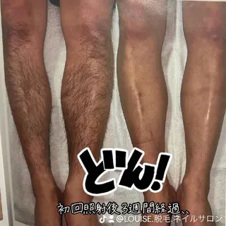 LOUISE.／脱毛所属・LOUISE. ／脱毛のエステ・リラクイメージ