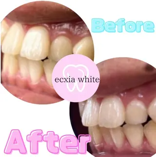 エクシアホワイトニング前橋店所属・セルフホワイトニング エクシア前橋店のその他イメージ