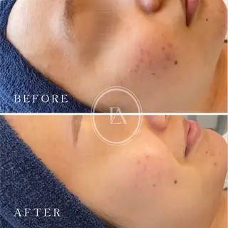 エストリア 所沢店のエステ・リラクイメージ