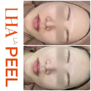 ハーブピーリング専門 BIOEL横浜のエステ・リラクイメージ