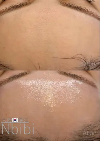 韓国🇰🇷価格 サロン_Nbibiのエステ・リラクイメージ