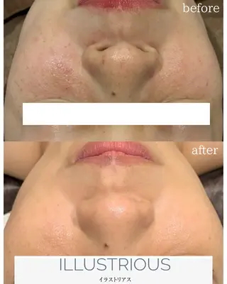 DahliaBeauty ダリアビューティー所属・DahliaBeau tyフェイシャル中村のエステ・リラクイメージ