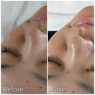 山城 悠菜のエステ・リラクイメージ