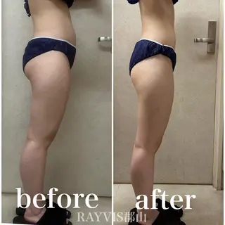 🌹毛穴小顔エステ レイビス郡山店🌹のエステ・リラクイメージ