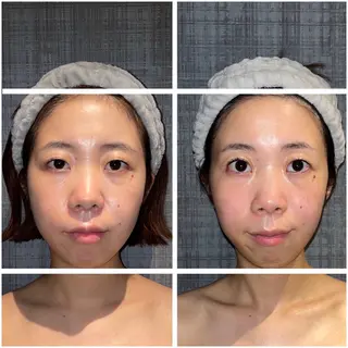 こりとりコルギ専門店MIICO所属・こりとりコルギ専門店 勝　友里奈のエステ・リラクイメージ