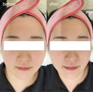 看護師が施術する 美容サロン/元治のエステ・リラクイメージ