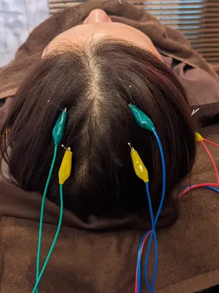 乃々鍼灸・整体院　表参道所属・乃々鍼灸整体院　植木 　【美容鍼/整体】のエステ・リラクイメージ