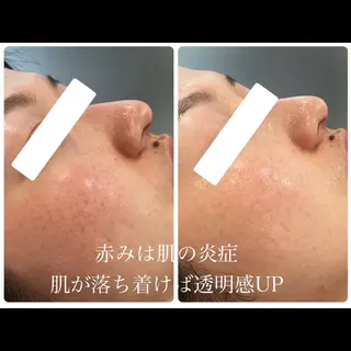 CHIO🌷心斎橋 毛穴・艶肌専門店のエステ・リラクイメージ