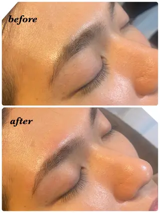 アイブロウ ハーブピーリング/韓国肌管理/フェイシャル/毛穴洗浄/眉毛/顔脱毛【糸脱毛専門】rev所属・ハーブピーリング🌹 毛穴洗浄❤️眉waxのエステ・リラクイメージ