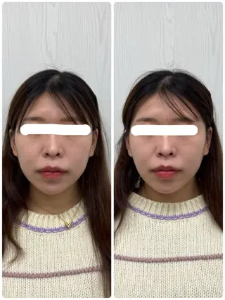 美容鍼×小顔矯正 ×美容整体　浜川泰仁のエステ・リラクイメージ