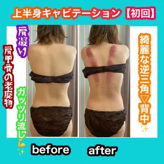 痩身/脱毛/ネイル HARUKAのエステ・リラクイメージ