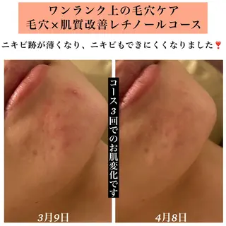 Bellesthe （ベルエステ）のエステ・リラクイメージ