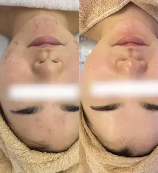 小顔×痩身専門サロンCLORE浦和店所属・石川 彩花のエステ・リラクイメージ