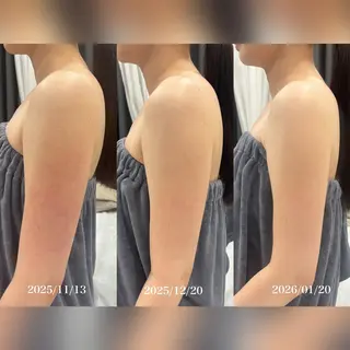 心斎橋🤍堀江.小顔 ハーブ.痩身クレビアのエステ・リラクイメージ