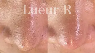 大久保 里奈のエステ・リラクイメージ