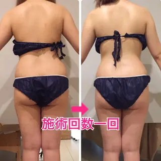 ショート カラー パーマ ヘアアレンジ メンズ キッズ ネイル マツエク・マツパ ‍痩身＆ボディ 結果出し🌟丹野のエステ・リラクイメージ