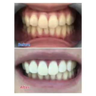 MBEAUTYSALON 千葉店・京成大久保所属・Melty 輝のその他イメージ