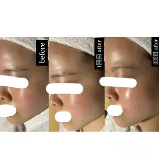 エステサロンPONO所属・PONO 天王寺／エステのエステ・リラクイメージ