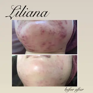 LILIANA所属・LILIANA ☆YURIのエステ・リラクイメージ