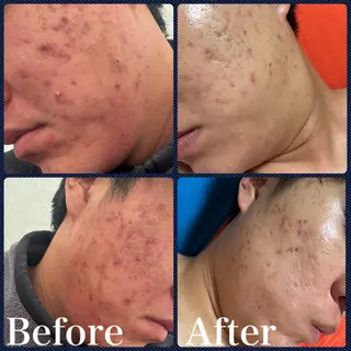 skin make salon -Olu's-所属・毛穴・肌質改善サロン ✨Tomaのその他イメージ