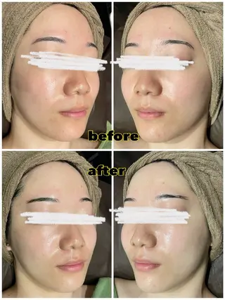 EARTH coiffure beaute 小山店所属・EARTH 小山店 shimaのエステ・リラクイメージ