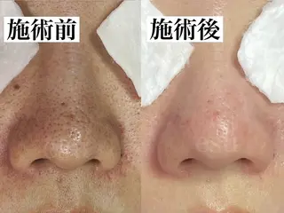 毛穴ケア専門店 esu(エス)のエステ・リラクイメージ