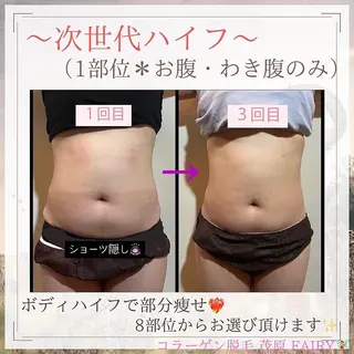 脱毛・ハイフ ・フェアリーのエステ・リラクイメージ