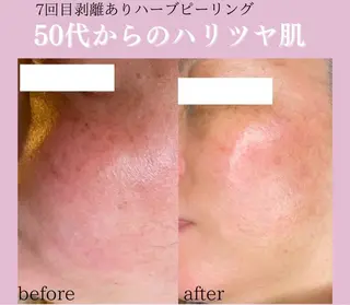 🦋肌改善 laule'a🦋のエステ・リラクイメージ