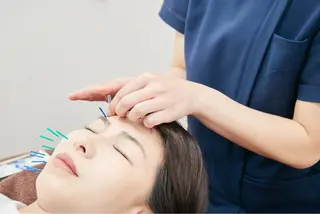 美容鍼　蒼月-aotsuki-所属・美容鍼「蒼月」 -アオツキ-のエステ・リラクイメージ