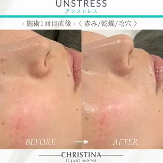 THE SALON -esme-のマツエク・マツパデザイン