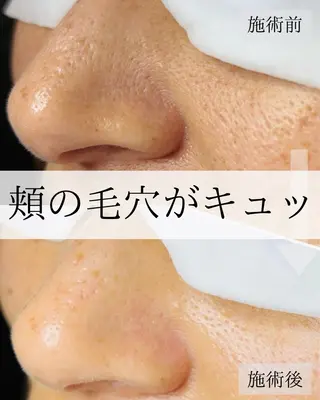 毛穴汚れ改善専門店/ 岸和田/リヒオルオルのエステ・リラクイメージ