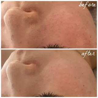 メンズ メナード岐阜市茜部 杉浦のエステ・リラクイメージ