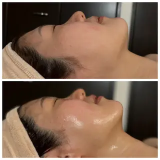 Mandarin Orange所属・毛穴から始める肌メン テマンダリンオレンジのエステ・リラクイメージ