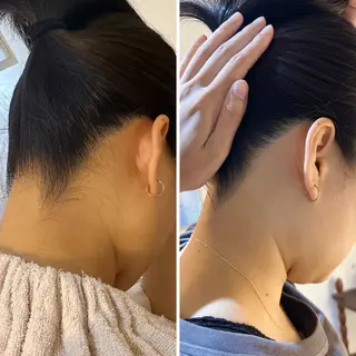 うなじ脱毛/美肌脱毛 LABELのエステ・リラクイメージ