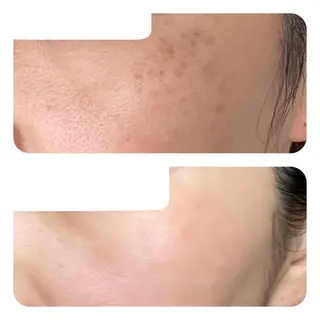 TIERRA(ティエラ)所属・TIERRA ♡のエステ・リラクイメージ