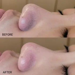 サロンドフララ 表参道店のエステ・リラクイメージ